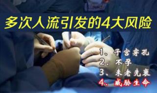 无痛人流手术过程 无痛人流手术过程